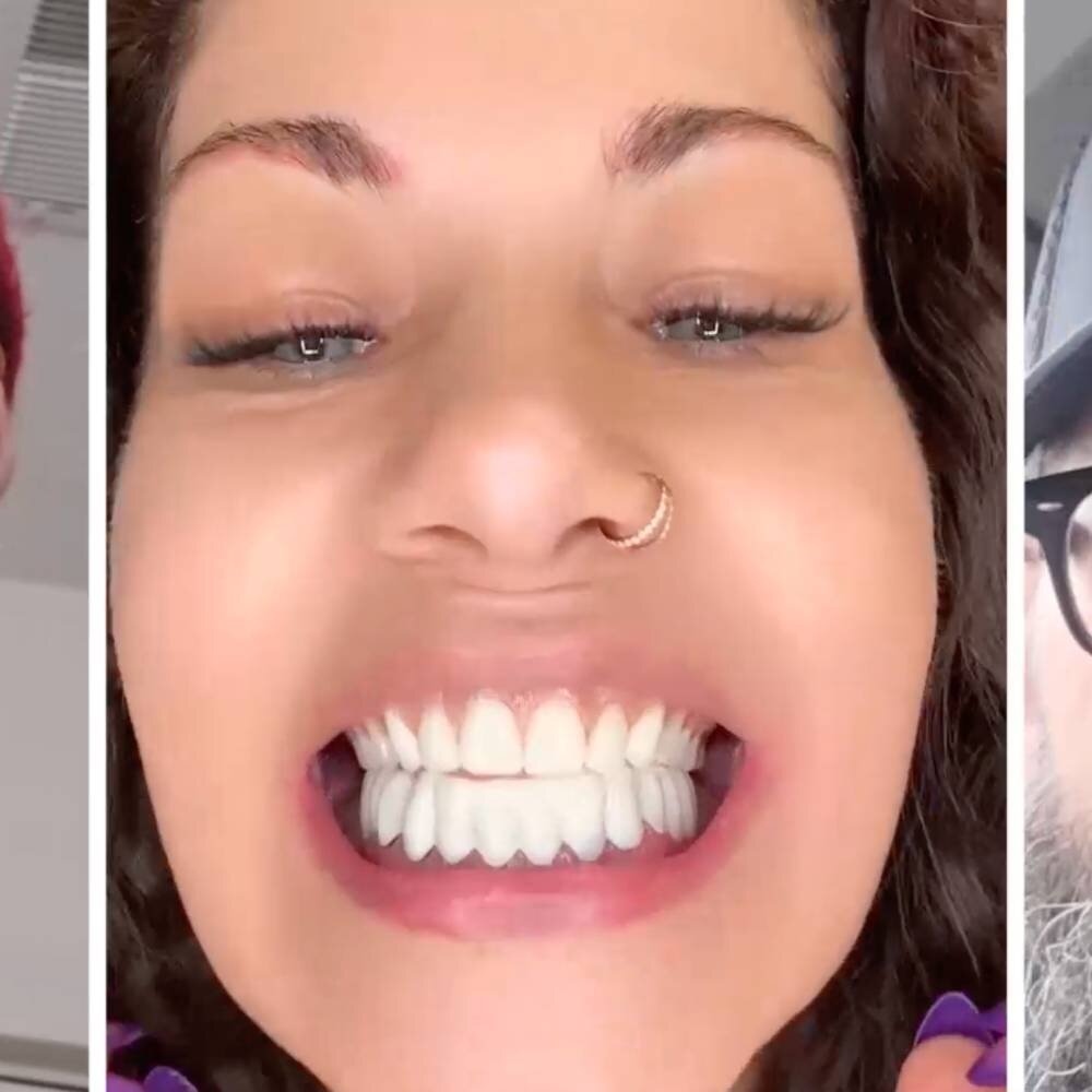 Verschiedene Menschen, die mit den WellaSmile-Verblendungen lächeln